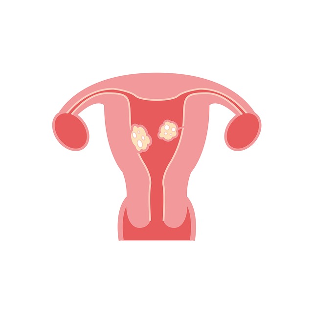 Heavy periods and intermenstrual bleeding