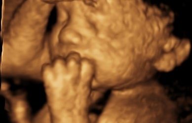 4d and Growth Scans – What to expect at your appointment