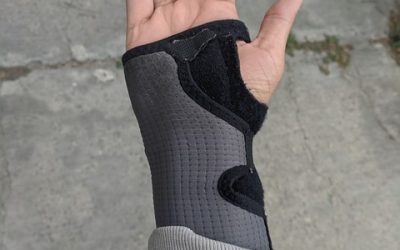 Carpal Tunnel Syndrome