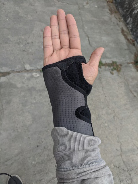 Carpal Tunnel Syndrome