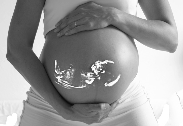 Dispelling ultrasound myths