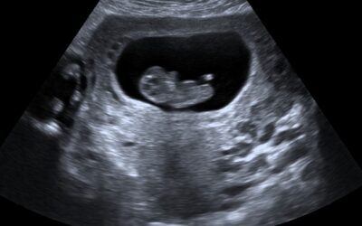 Your Safety, Our Priority: Why You Can Trust Somerset Early Scans